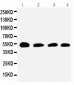 Anti-Serpin C1/Antithrombin-III Antibody