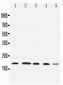 Anti-Diubiquitin Antibody