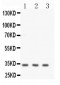 Anti-Calponin Antibody