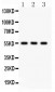 Anti-PLTP Antibody