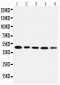 Anti-Cortisol Binding Globulin Antibody