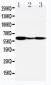 Anti-G-Protein Coupled Receptor 30 Antibody