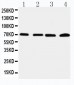 Anti-IRAK2 Antibody