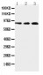 Anti-TLR2 Antibody