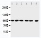 Anti-PIAS1 Antibody