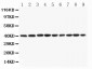 Anti-PON1 Antibody