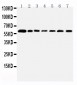 Anti-PRMT4 Antibody