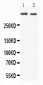 Anti-Huntingtin Antibody