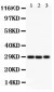 Anti-CSEN Antibody