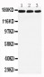 Anti-LRP5 Antibody