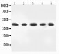 Anti-MEK4 Antibody