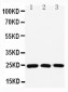 Anti-Rab11A Antibody