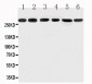 Anti-Mucin 5AC Antibody