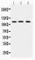 Anti-TRPC4 Antibody