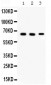 Anti-Alpha Internexin Picoband Antibody