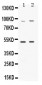 Anti-MAP3K8 Picoband Antibody