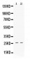 Anti-PF4 Picoband Antibody