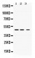 Anti-Perilipin 3 Picoband Antibody