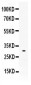 Anti-Mast Cell Tryptase Picoband Antibody