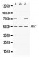 Anti-ABAT Picoband Antibody