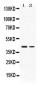 Anti-Abhd5 Picoband Antibody