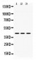 Anti-ACAA2 Picoband Antibody