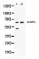 Anti-ACADVL Picoband Antibody