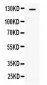 Anti-ATP citrate lyase Picoband Antibody