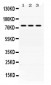 Anti-ACSL1 Picoband Antibody