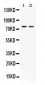 Anti-ACVR2A Picoband Antibody