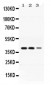 Anti-ADH4 Picoband Antibody