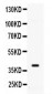 Anti-ADK Picoband Antibody