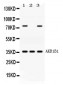 Anti-AKR1B1 Picoband Antibody