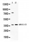 Anti-AKR1C1/C2 Picoband Antibody