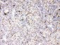 Anti-Apolipoprotein B Picoband Antibody