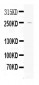 Anti-Apolipoprotein B Picoband Antibody