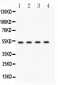 Anti-BDKRB2 Picoband Antibody