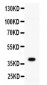 Anti-CD40/TNFRSF5 Picoband Antibody