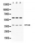 Anti-EPCAM Picoband Antibody