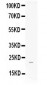 Anti-FGF21 Picoband Antibody