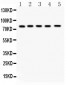 Anti-FSH Receptor Picoband Antibody