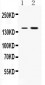 Anti-Insulin Receptor Picoband Antibody