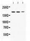 Anti-KDM5B Picoband Antibody