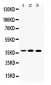 Anti-LDHA Picoband Antibody