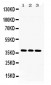 Anti-LDHB Picoband Antibody