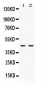 Anti-NR2F6 Picoband Antibody