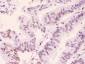 Anti-PML Protein Picoband Antibody