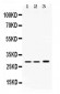 Anti-PSMA1 Picoband Antibody