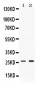 Anti-PSMA2 Picoband Antibody