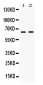 Anti-Nectin-4/PVRL4 Picoband Antibody